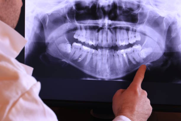 Best Knocked-Out Tooth Emergency  in Newcastle, WY