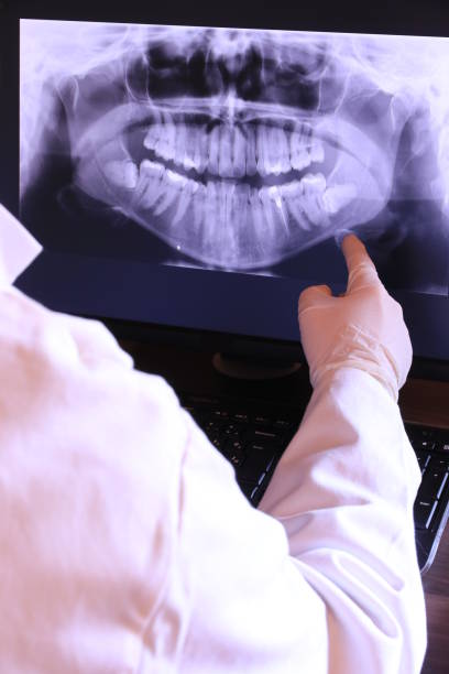 Best Root Canal Emergency Dentist  in Newcastle, WY